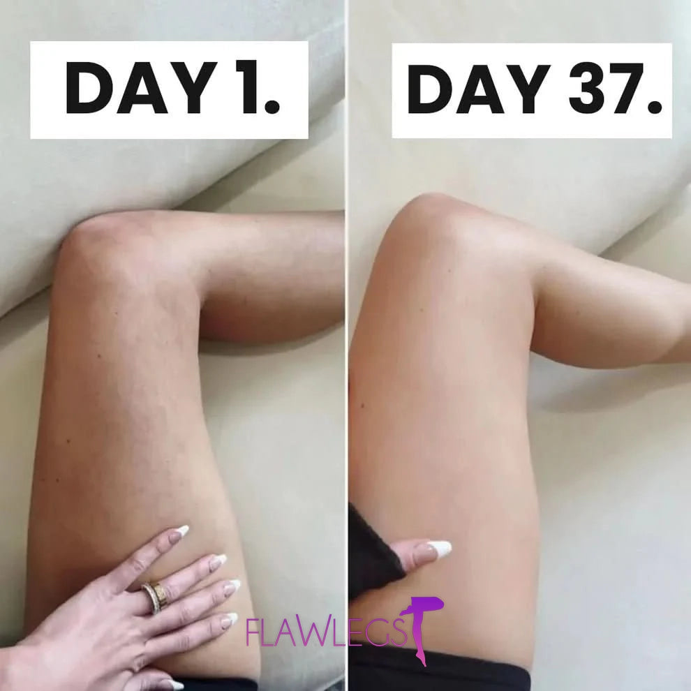 FlawLegs - Las Medias anticelulíticas de las famosas [COMPRA 1 Y LLEVA 3]
