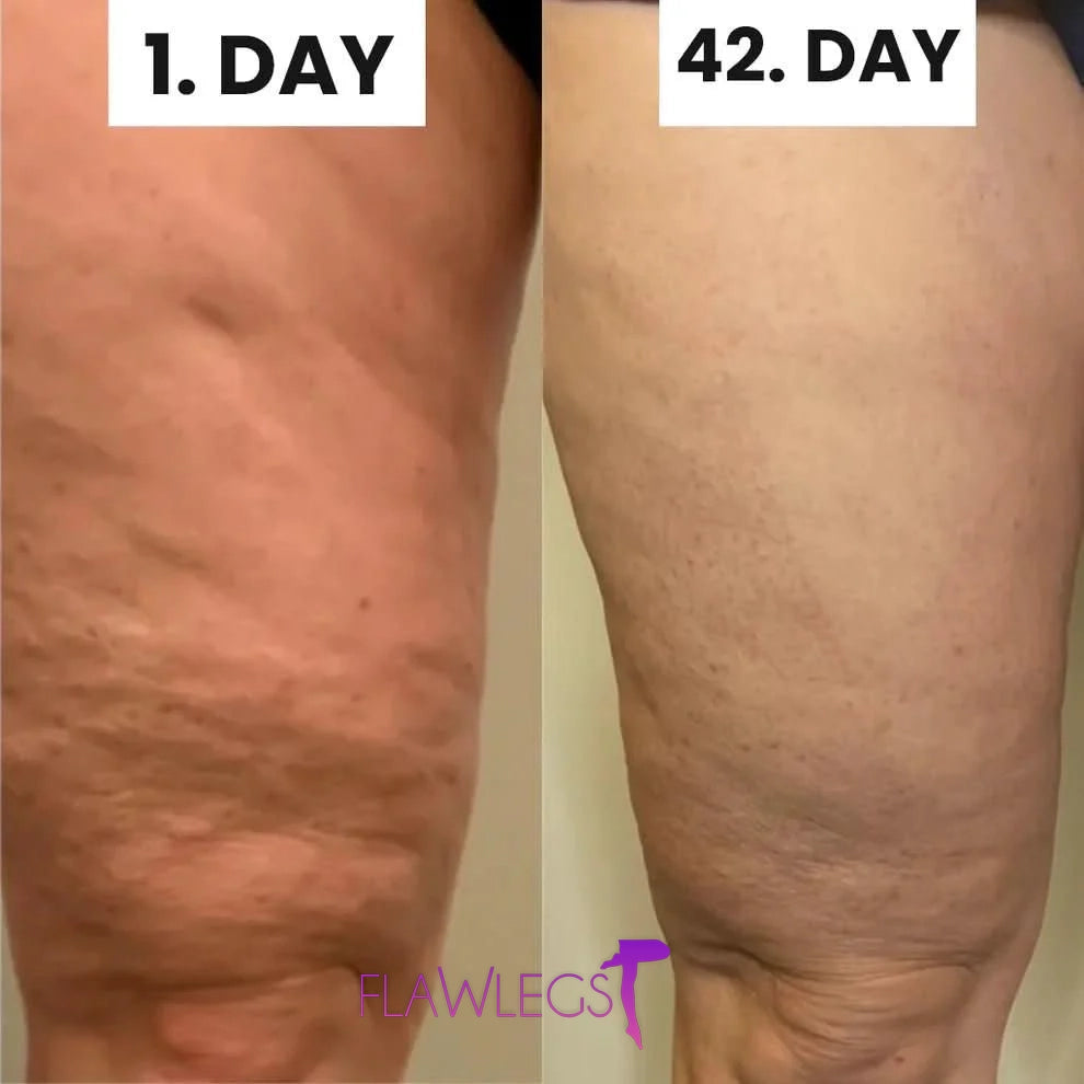 FlawLegs - Las Medias anticelulíticas de las famosas [COMPRA 1 Y LLEVA 3]